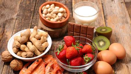 image of common allergen foods such as peanuts, eggs, shell fish, strawberries, milk, chocolate, and kiwi